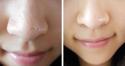 沈陽沈河華顏美整形美容醫(yī)院怎么樣？沈陽沈河華顏美整形美容醫(yī)院簡介|醫(yī)生團隊|口碑評價！