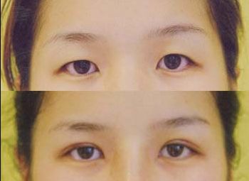 無(wú)錫市哪家整形醫(yī)院好？揭秘?zé)o錫地區(qū)口碑最佳整形醫(yī)院！