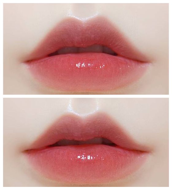 揭秘上海注射玻尿酸醫(yī)院排行榜，哪家好的口碑最高？