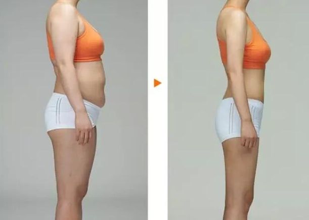 常州去胎記哪家醫(yī)院好？專家推薦常州哪家醫(yī)院胎記治療效果好