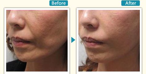 杭州哪家瘦腿針醫(yī)院好？全面解析杭州最受用戶歡迎的瘦腿針醫(yī)院推薦