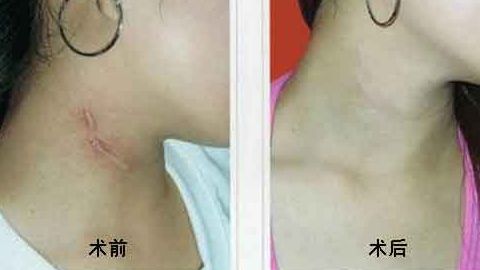 上海中西醫(yī)結(jié)合醫(yī)院整形美容科靠譜嗎？聽說口碑不錯！