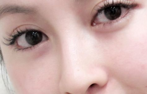 在烏魯木齊有哪些值得推薦的開眼角好醫(yī)院？