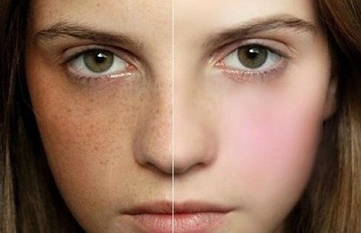 2023中山魚尾紋打玻尿酸正規(guī)醫(yī)生上榜TOP10(陳瑩、楊碩、田治國口碑不錯的醫(yī)生，快來選！)