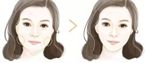 上海哪家下頜骨醫(yī)院好？解析上海下頜骨疾病常見病例及專業(yè)治療！