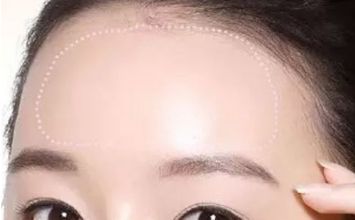 蘇州哪家黃褐斑醫(yī)院好？專業(yè)醫(yī)生推薦，讓你告別黃褐斑困擾！