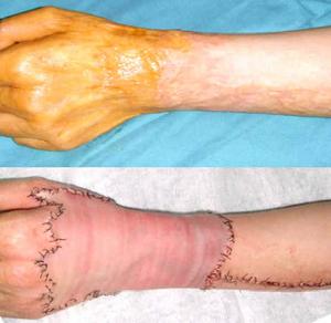 米德傲吸脂技術(shù)優(yōu)勢(shì)分析：醫(yī)生評(píng)價(jià)、收費(fèi)信息先解密！杭州藝星權(quán)威專(zhuān)家！