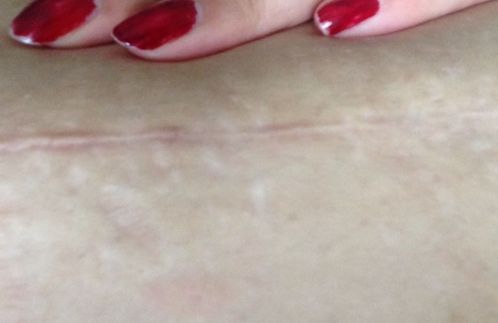 南京哪家醫(yī)院雙眼皮技術(shù)好？醫(yī)生經(jīng)驗(yàn)豐富，效果一流！