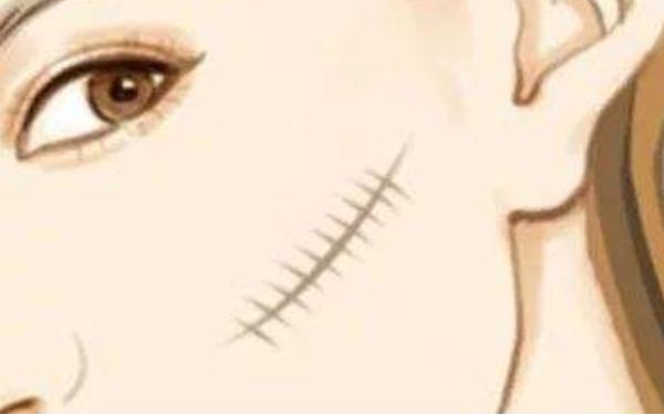 廣州康華清醫(yī)療美容門診部醫(yī)生有哪些擅長(zhǎng)項(xiàng)目？醫(yī)院技術(shù)一覽如何？