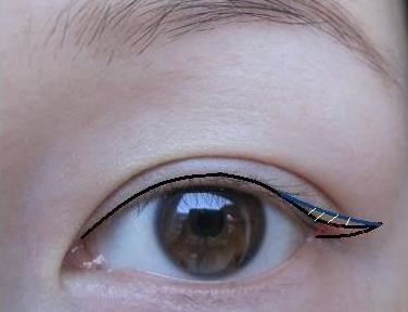 昆明哪家醫(yī)院專業(yè)祛除疤痕效果好？