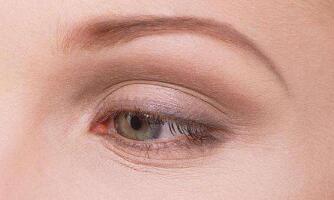 西京醫(yī)院劉恒鑫雙眼皮手術(shù)成功案例分享