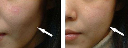 邯鄲美容整形醫(yī)院哪家好？專業(yè)品質(zhì)口碑贊譽醫(yī)院推薦！