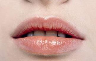 2023寧波玻尿酸去生長紋正規(guī)醫(yī)生排行榜前十名(陳新平、李鶯、卜雙燕好評不貴)