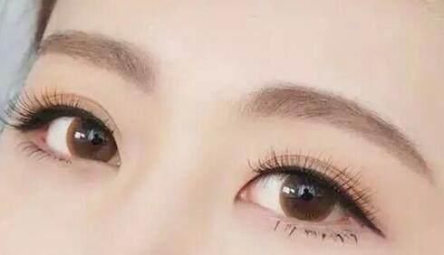 2023廈門眉間紋填充脂肪醫(yī)生評分前10強(qiáng)(魏嘉宏、李國明、李博價(jià)格不貴口碑好)