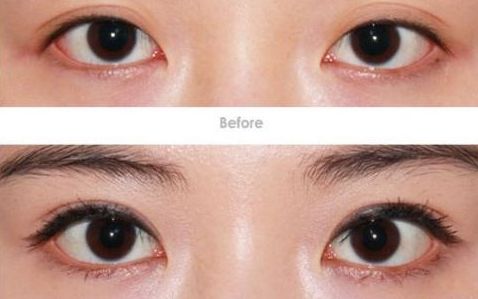 淮安瘦臉針哪家技術(shù)好？探究淮安市臉部瘦臉針技術(shù)領(lǐng)先的醫(yī)療機(jī)構(gòu)