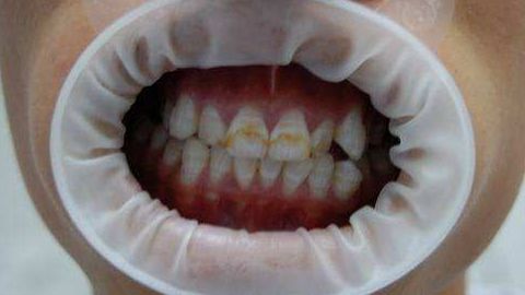 濰坊天宏整形醫(yī)院的口碑好嗎？張明欣技術(shù)擅長(zhǎng)的具體內(nèi)容是什么？?jī)r(jià)目表在文末！