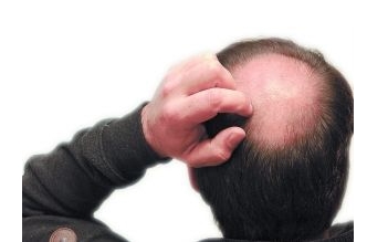 袁強(qiáng)拉皮除皺術(shù)的技術(shù)及年輕緊致效果，你知道嗎？