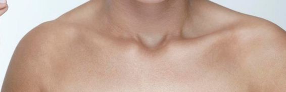 沈陽(yáng)墊鼻子醫(yī)院哪家好？墊鼻子手術(shù)效果怎么樣？