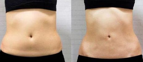 上海疤痕科醫(yī)院哪家好？綜合評測2023，含專家問答與真實患者見證