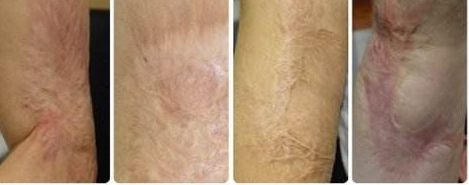 南京去紅血絲醫(yī)院專業(yè)推薦：哪家醫(yī)院技術(shù)高效、費(fèi)用合理？