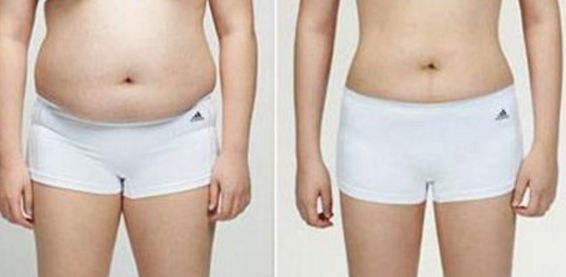 南京哪家醫(yī)院的祛疤效果好，如何選擇南京祛疤醫(yī)院