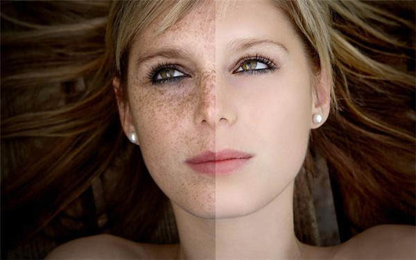 2023東莞臉部祛黑痣大型醫(yī)生口碑排名(黃利、韓勇、黃尾全口碑、價(jià)格揭秘)