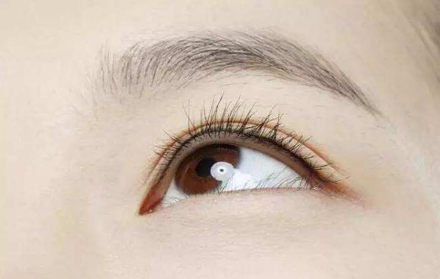 杭州祛眼袋手術(shù)哪家醫(yī)院好？詳細(xì)醫(yī)院排名及患者口碑調(diào)查