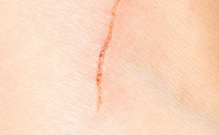 深圳去眼袋醫(yī)院哪家技術(shù)先進，效果好