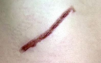 探尋開封市美容醫(yī)院的排名與口碑，哪家值得信賴？