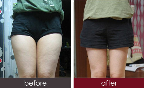 2023湖州魚尾紋自體填充榜單前10位專家(陳育哲、張振偉、張勁國(guó)是不錯(cuò)的選擇！)