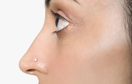 怎樣看待衢州蘇杭醫(yī)美醫(yī)院的胎記治療效果？