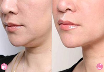 瀘州去疤痕哪家醫(yī)院好？疤痕修復盡在XXX?？漆t(yī)院！