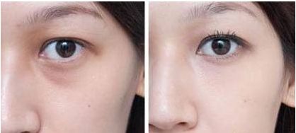 杭州哪家醫(yī)院做狐臭手術(shù)好且靠譜？