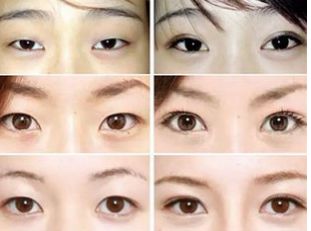 武漢去眼袋哪家好可信？揭秘眼袋整形專家推薦排行榜！