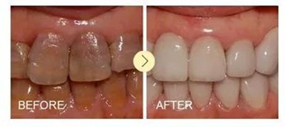 西安畫美楊萬忠鼻部整形效果解析！楊萬忠醫(yī)生簡介及收費準(zhǔn)則！