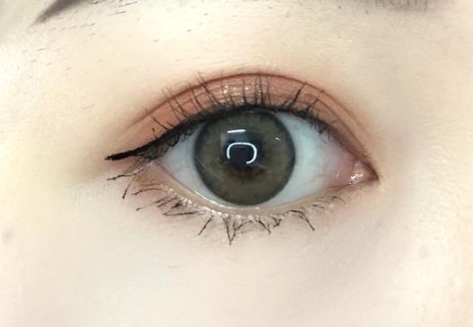 重慶去疤痕醫(yī)院有哪些專家？哪家去疤痕醫(yī)院好？