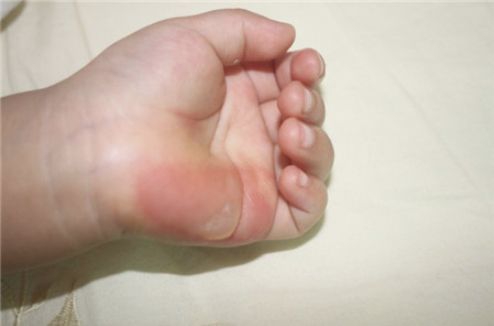 雙眼皮手術(shù)武漢哪家醫(yī)院好？熱門推薦及口碑解讀