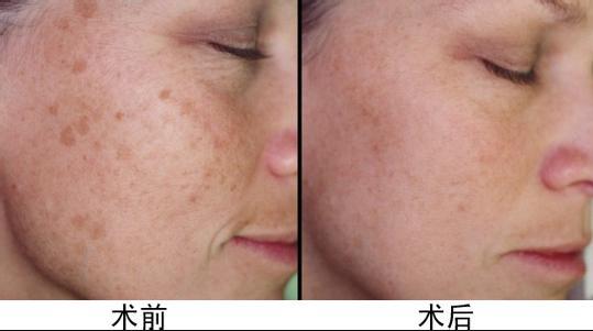 上海假體隆胸醫(yī)師推薦！王濤、亓發(fā)芝、劉天一帶您尋找完美曲線！