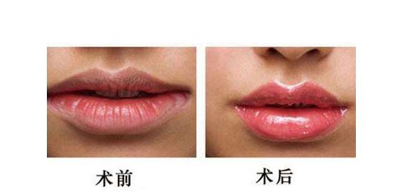 江蘇哪家醫(yī)院做激光祛斑好？