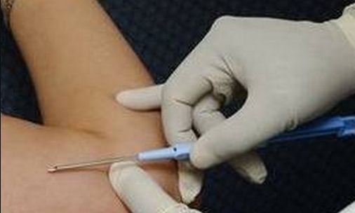 上海手術眼袋好的醫(yī)院有哪些？