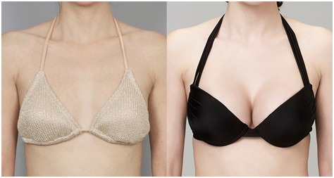 附去眼袋果圖，中心醫(yī)院邱曉東怎么樣治療效果如何