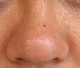 2023廣東熱瑪吉淡化眼部細(xì)紋醫(yī)生評(píng)價(jià)TOP10(程寧新、劉志剛、羅盛康有名收費(fèi)價(jià)格不貴)