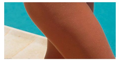 西安去雀斑醫(yī)院排名及用戶口碑評價(jià)，哪家醫(yī)院效果更好？