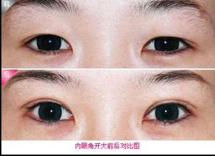 廊坊地區(qū)瘦臉針醫(yī)院排行榜2023：哪家醫(yī)院的瘦臉針效果好？