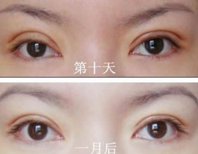 長春哪家醫(yī)院治痘痘好？了解長春市治療青春痘的?？漆t(yī)院及價格