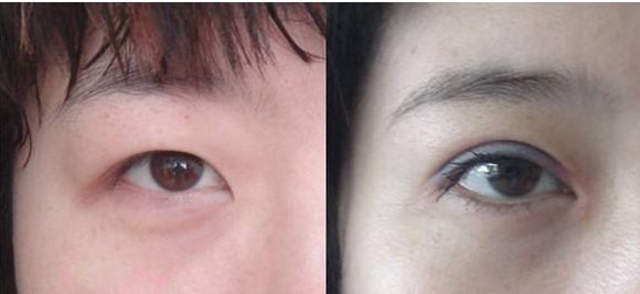 北京豐胸整形醫(yī)院哪家好？綜合評價和患者口碑推薦