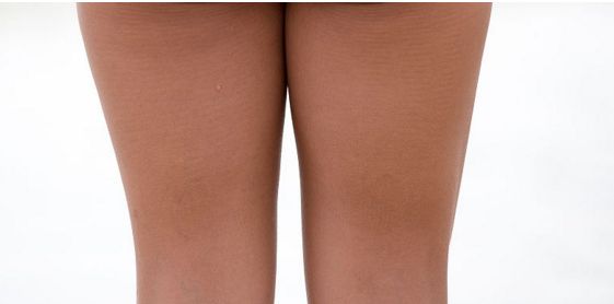 杭州治疤痕那個(gè)醫(yī)院好？解析杭州治疤痕醫(yī)院榜單