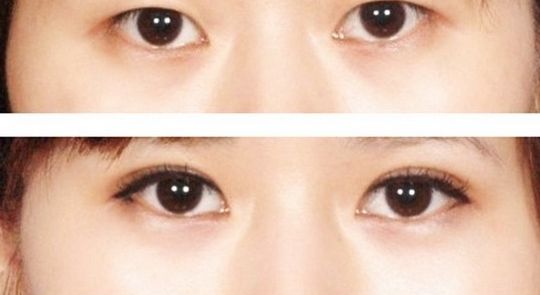 浙江激光祛斑醫(yī)院排名及評價(jià)，哪家好？