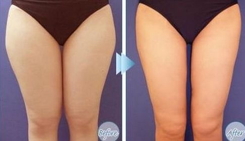 如何選擇最適合您的除腋臭治療醫(yī)院？全國哪家醫(yī)院好？