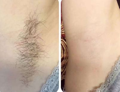 上海整形醫(yī)院哪家的好？最權(quán)威的排名榜單來幫你挑選！